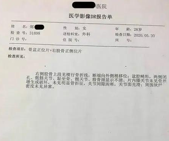 先天畸形重度骨折绝望的她在深圳正康骨科医院重新站立